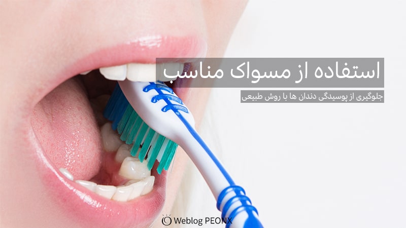 استفاده از مسواک مناسب برای پوسیدگی از دندان ها
