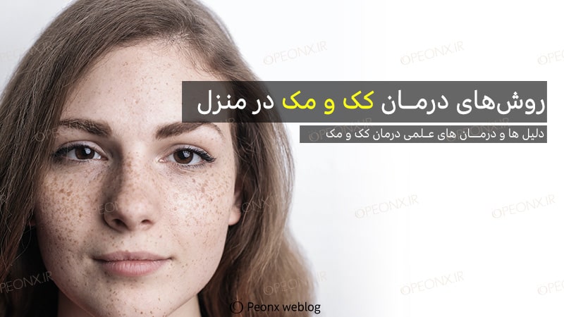 روش‌های درمان کک و مک