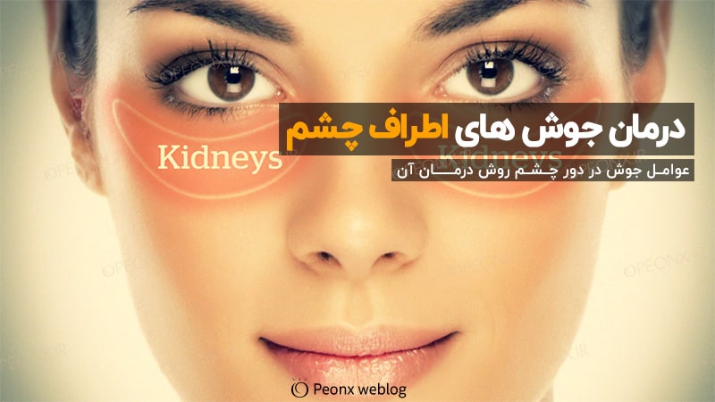 جوش صورت اطراف ناحیه چشم