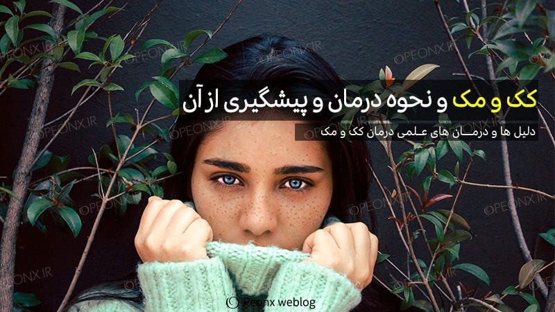 کک و مک و نحوه درمان و پیشگیری از آن