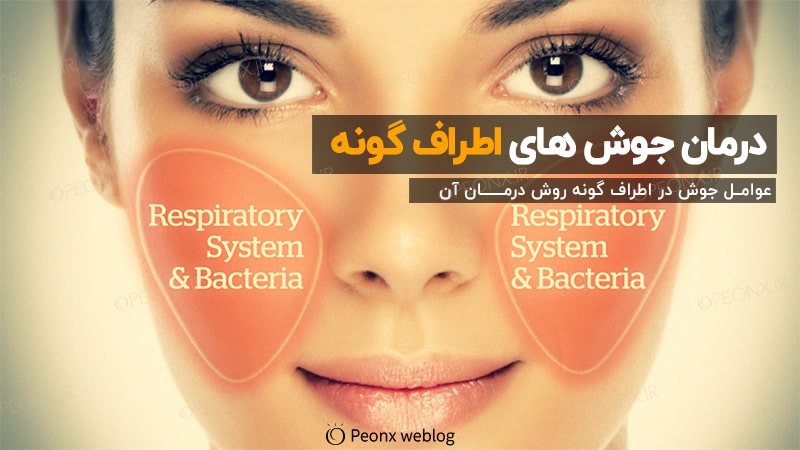 جوش گونه