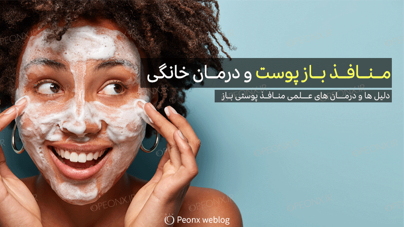 روش‌های درمان خانگی منافذ باز پوست