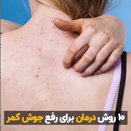 چرا پشت کمر جوش میزند؟