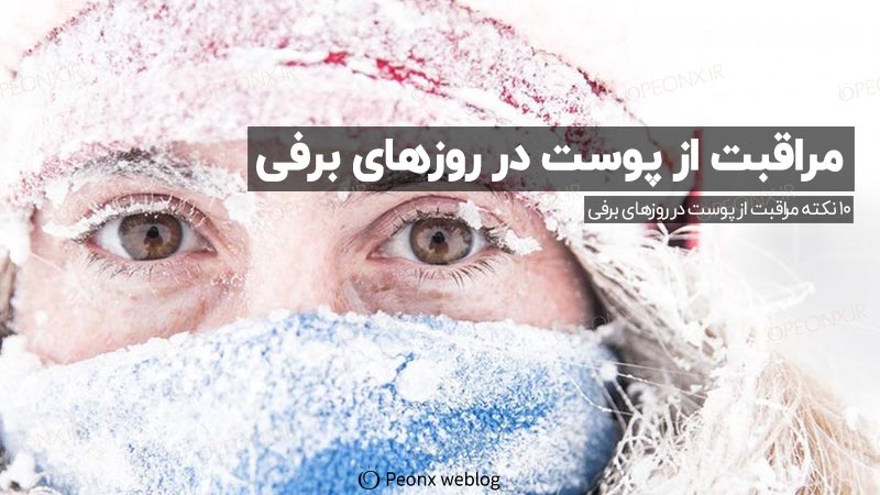 مراقبت از پوست در روزهای برفی