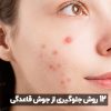 روش های جلوگیری از جوش‌های قاعدگی