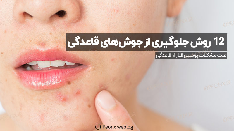 روش‌های جلوگیری از جوش‌های قاعدگی