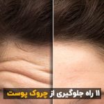 11 راه جلوگیری از پیری و چروک پوست