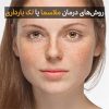 روش‌های درمان ملاسما یا لک بارداری