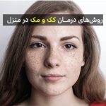 کک و مک و نحوه درمان و پیشگیری از آن