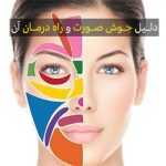 دلیل جوش صورت چیست ؟
