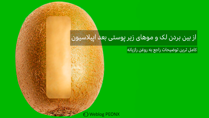از بین بردن لک های اپلاسیون