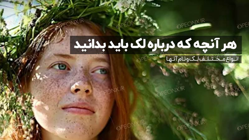 لک من کدام است؟ انواع مختلف لک