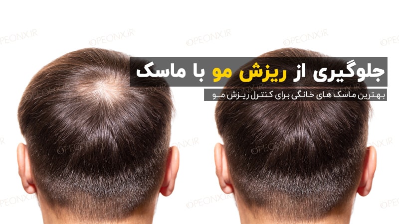 بهترین ماسک های درمان ریزش مو