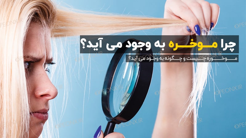 جلوگیری از ایجاد موخوره