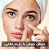 درمان جوش با رژیم غذایی