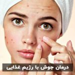 درمان جوش با رژیم غذایی