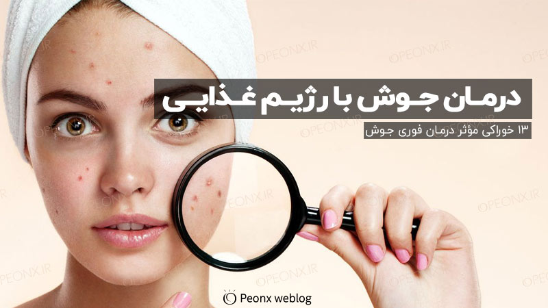 جوش و آکنه مسئله‌ای است که امروزه اکثر افراد درگیرش هستند. و دیگر نوع پوست، جنسیت و سن و سال مطرح نیست. بلکه نوع تغذیه و سبک زندگی باعث بروز جوش و آکنه می‌شود.