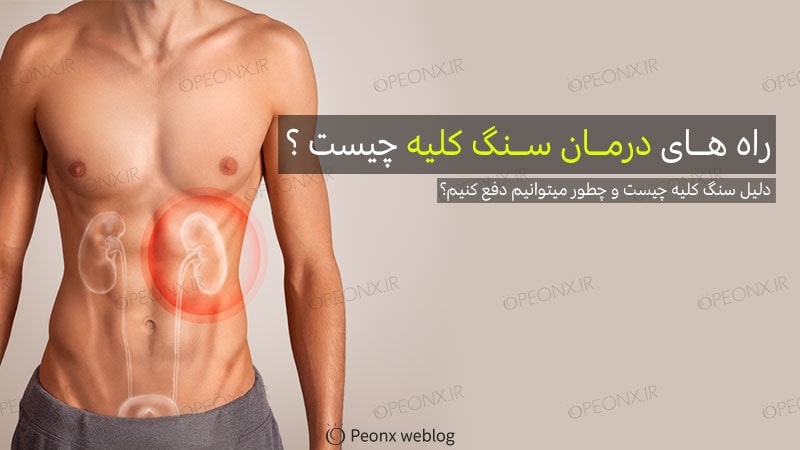 درمان سنگ کلیه در منزل