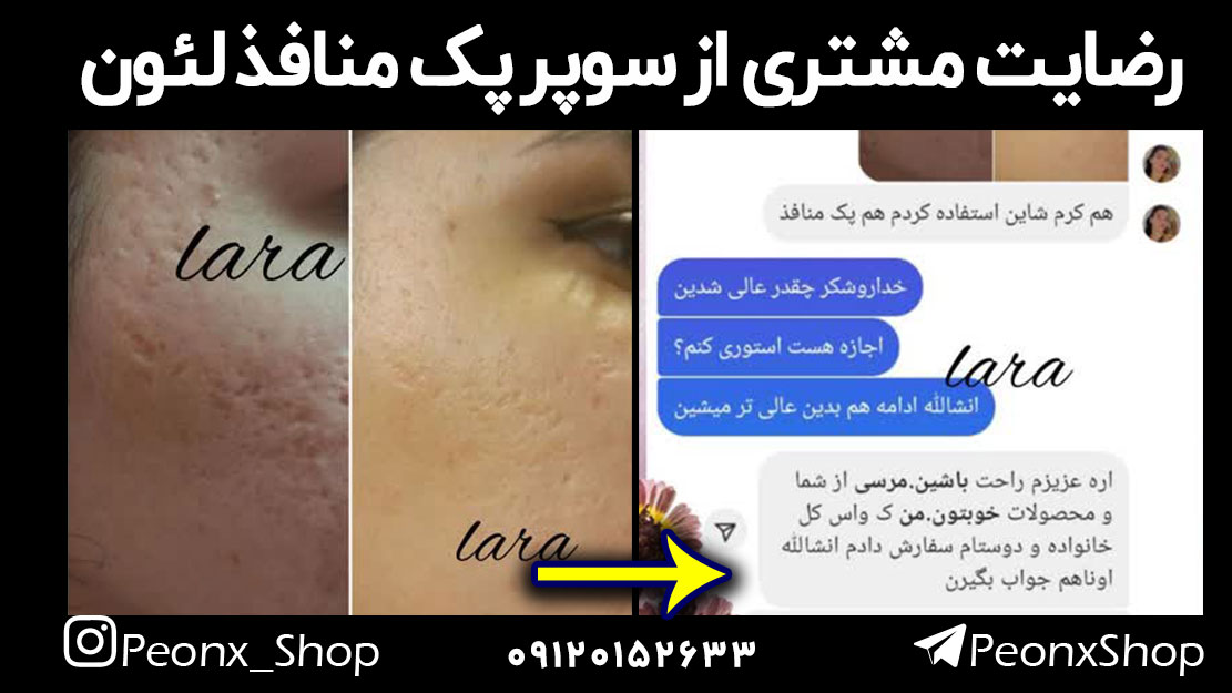 درمان منافذ پوست در منزل