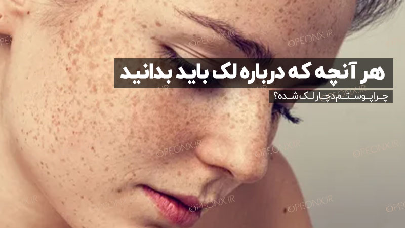 دلایل ایجاد لک