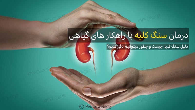 دلیل سنگ کلیه چیست و چطور آن را دفع کنیم؟