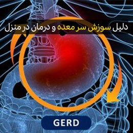 دلیل سوزش سر معده1