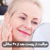 مراقبت از پوست بعد از 40 سالگی