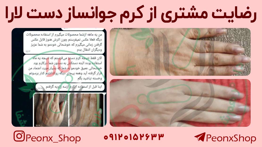 رضایت مشتری از کرم جوانساز دست لارا