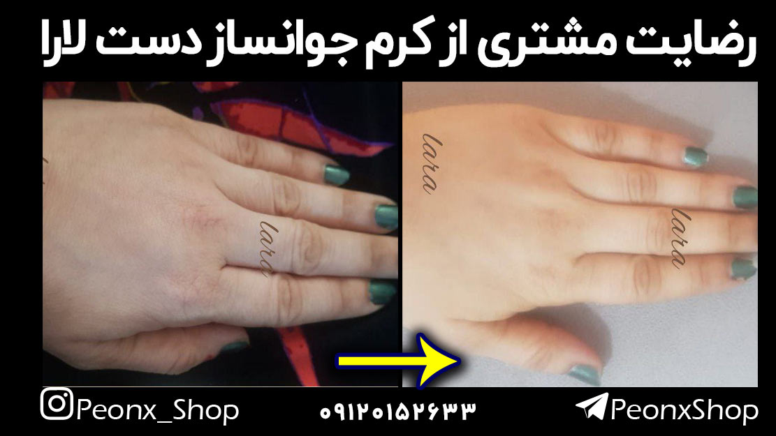 رضایت مشتری از کرم دست