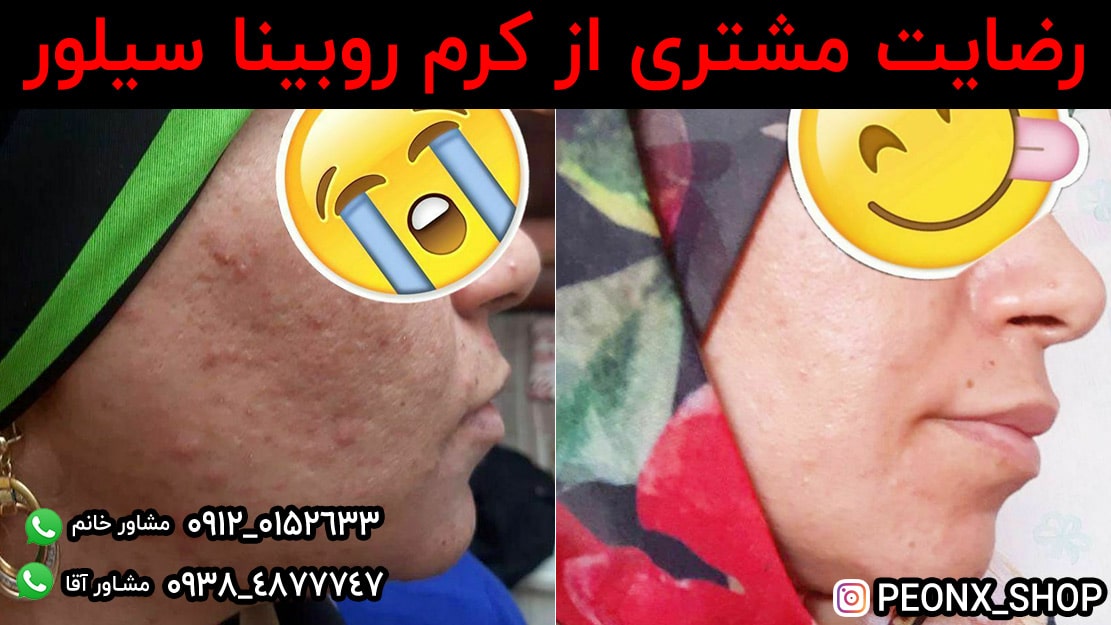 رضایت مشتری از روبینا سیلور