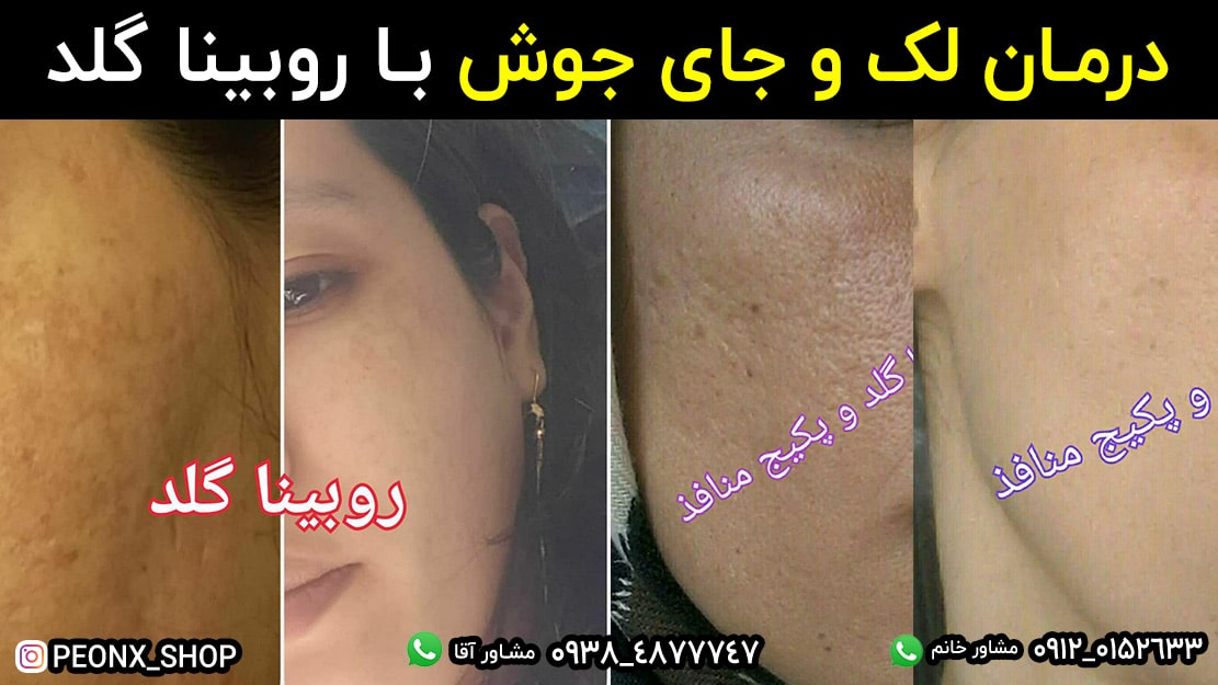 رضایت مشتری از روبیناگلد