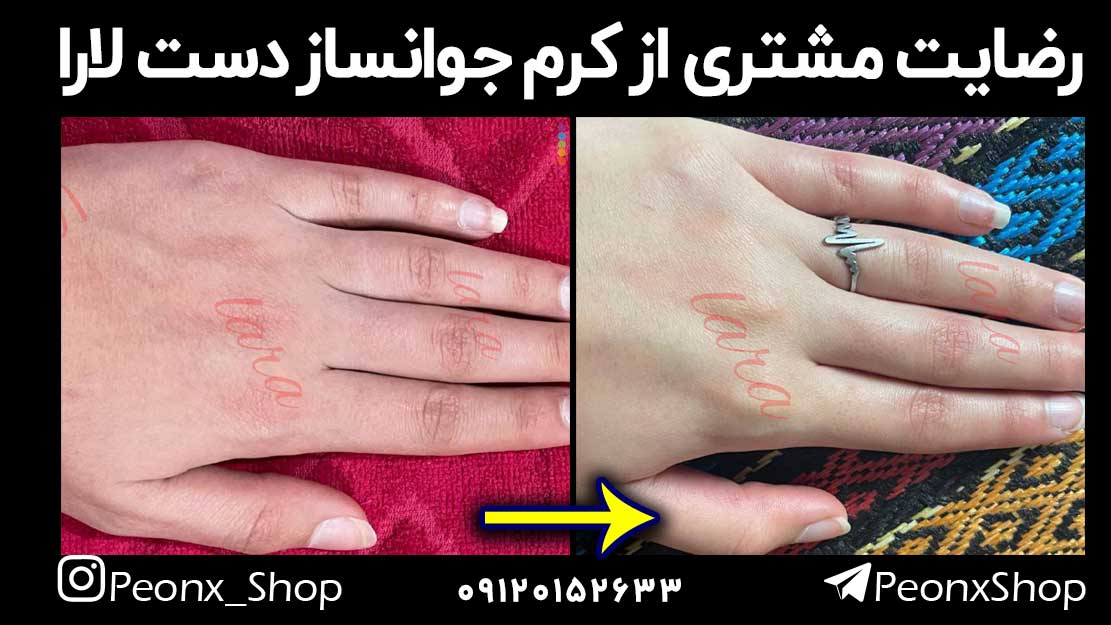 کرم جوانساز دست لارا