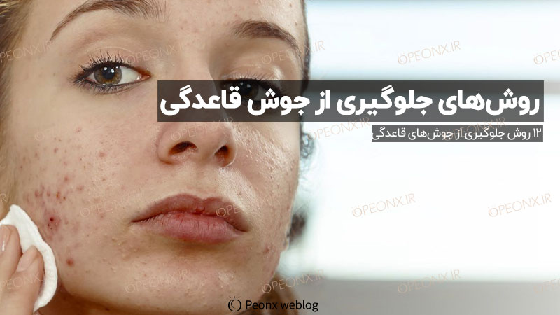 جوش های قاعدگی و جلوگیری از ایجاد جوش قاعدگی