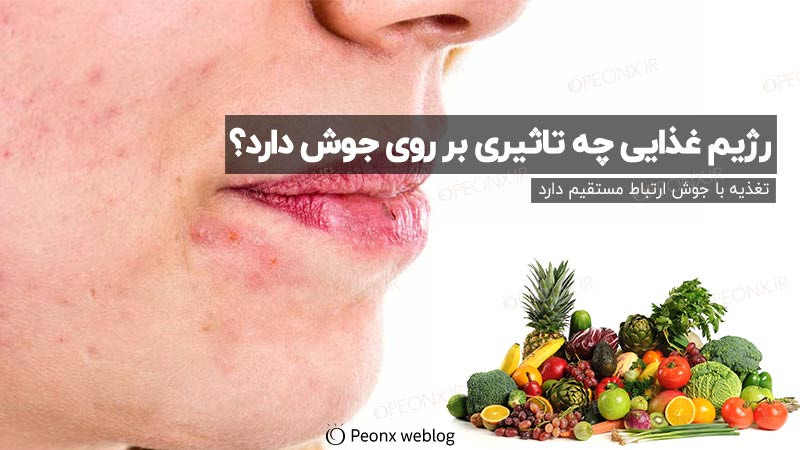 رژیم غذایی چه تاثیری بر روی جوش دارد؟
