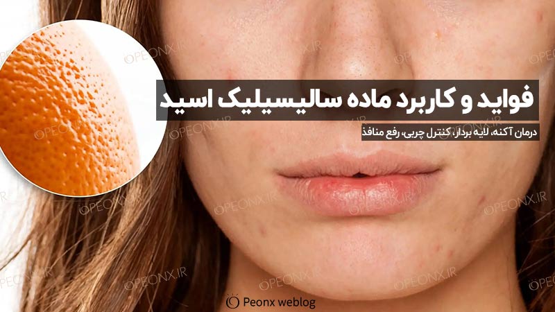 فواید و کاربردهای اصلی سالیسیلیک اسید