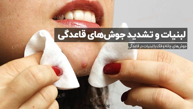 لبنیات و تشدید جوش قاعدگی