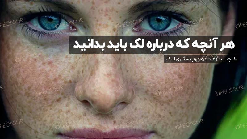 لک چیست و چه عواملی باعث بروز لک می‌شود؟