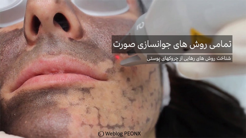 ليزردرماني برای پیری پوست ليزردرماني برای پیری پوست