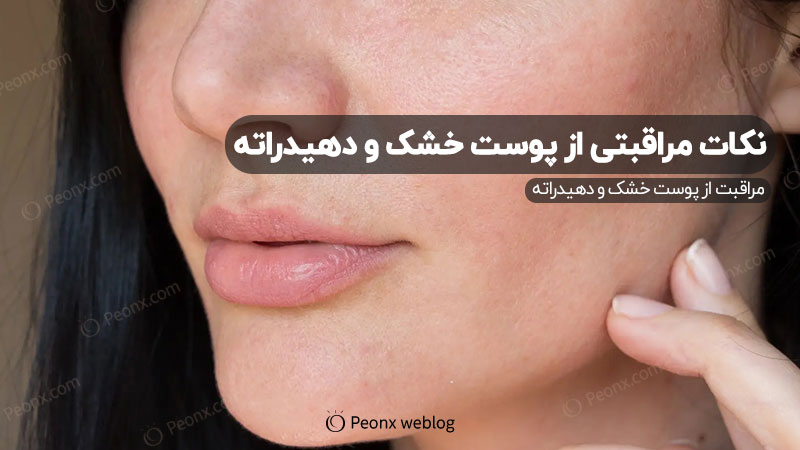 تفاوت پوست خشک و پوست دهیدراته