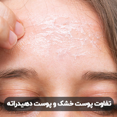 تفاوت پوست خشک و پوست دهیدراته