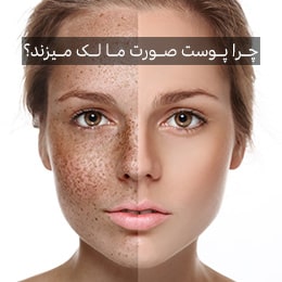 آشنایی با انواع لکهای پوستی