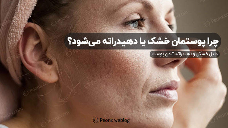 تفاوت پوست خشک و پوست دهیدراته